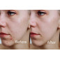 Aphrona LED Facial Mask: Achieve Radiant, Acne-Free Skin at Home! Aphrona LED Facial Mask: Achieve Radiant, Acne-Free Skin at Home!