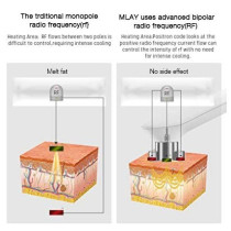 MLAY Appareil RF Anti-Âge: Lifting Visage, Réduction des Rides, Rajeunissement à Domicile
