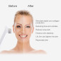 MLAY RF Skin Tightening Device: Professional Anti-Aging for Face & Body - Wrinkle Reduction & Lifting at Home MLAY RF Skin Tightening Device: Professional Anti-Aging for Face & Body - Wrinkle Reduction & Lifting at Home