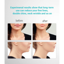 Ms.Ｗ Face Massager,l'appareil antirides