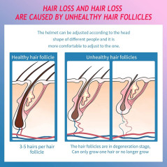 CNV Hair Regrowth System: Laser Therapy for Thicker, Fuller Hair - At Home!