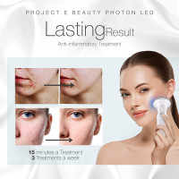 Thérapie LED Anti-Acné Project E Beauty : Une Peau Claire et Saine, Sans Imperfections !