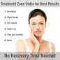 Silkn Titan: At-Home Skin Tightening & Anti-Aging Device - Reduce Wrinkles & Restore Youthful Skin! Silkn Titan: At-Home Skin Tightening & Anti-Aging Device - Reduce Wrinkles & Restore Youthful Skin!