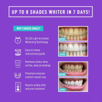 iSmile Advanced Teeth Whitening Kit: Get a Brighter Smile Fast with LED Light!