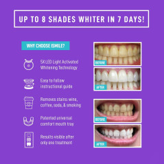iSmile Advanced Teeth Whitening Kit: Get a Brighter Smile Fast with LED Light!