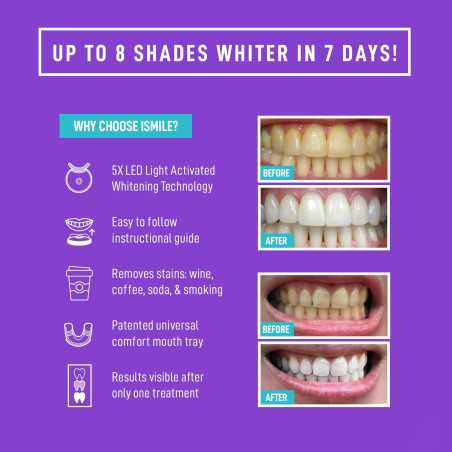 iSmile Advanced Teeth Whitening Kit: Get a Brighter Smile Fast with LED Light!