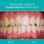 Opalescence Go 10 Mint: Whiten Your Smile Effortlessly! Prefilled Teeth Whitening Trays Opalescence Go 10 Mint: Whiten Your Smile Effortlessly! Prefilled Teeth Whitening Trays