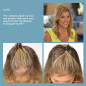 HairMax Laser Comb: FDA-Cleared Hair Growth Treatment - Regrow Thicker, Fuller Hair!