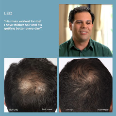 HairMax Laser Hair Growth Comb, FDA Cleared, Ultima 12, Laser Hair Growth Treatment for Men & Women, Thinning Hair Treatment for