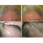 HairMax RegrowMD Laser Cap: FDA-Cleared Hair Growth - See Results in Months! HairMax RegrowMD Laser Cap: FDA-Cleared Hair Growth - See Results in Months!