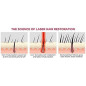 iRestore Laser Hair Growth System: FDA Cleared, Regrow Thicker Hair! iRestore Laser Hair Growth System: FDA Cleared, Regrow Thicker Hair!