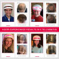 iRestore Laser Hair Growth System: FDA Cleared, Regrow Thicker Hair! iRestore Laser Hair Growth System: FDA Cleared, Regrow Thicker Hair!