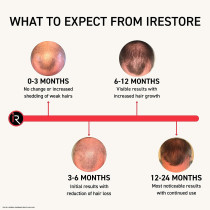 iRestore Essential Laser Hair Growth System | FDA Cleared Hair Regrowth Laser Cap - Red Light Therapy Hair Growth, Hair Loss