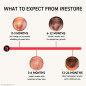 iRestore Laser Hair Growth System: FDA Cleared, Regrow Thicker Hair! iRestore Laser Hair Growth System: FDA Cleared, Regrow Thicker Hair!