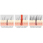 iRestore Laser Hair Growth System: FDA Cleared, Regrow Thicker Hair! iRestore Laser Hair Growth System: FDA Cleared, Regrow Thicker Hair!