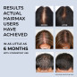 HairMax RegrowMD: Casque Laser Anti-Chute, Repousse des Cheveux Prouvée (FDA) HairMax RegrowMD: Casque Laser Anti-Chute, Repousse des Cheveux Prouvée (FDA)
