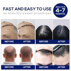 Laser Hair Growth Cap - Red Light Therapy for Hair Regrowth
