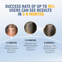 Laser Comb for Hair Growth: Medical-Grade Red Light Therapy Device