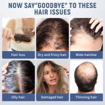 Laser Comb for Hair Growth: Medical-Grade Red Light Therapy Device