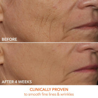 Dr. Dennis Gross DRx SpectraLite FaceWare Pro: LED Mask for Anti-Aging