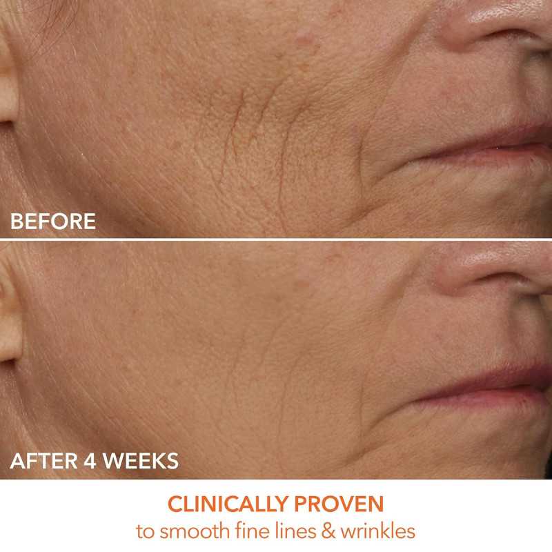 Dr. Dennis Gross DRx SpectraLite FaceWare Pro: LED Mask for Anti-Aging