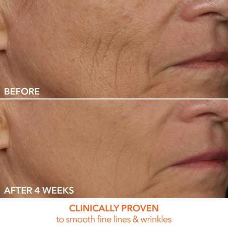 Dr. Dennis Gross DRx SpectraLite FaceWare Pro: LED Mask for Anti-Aging
