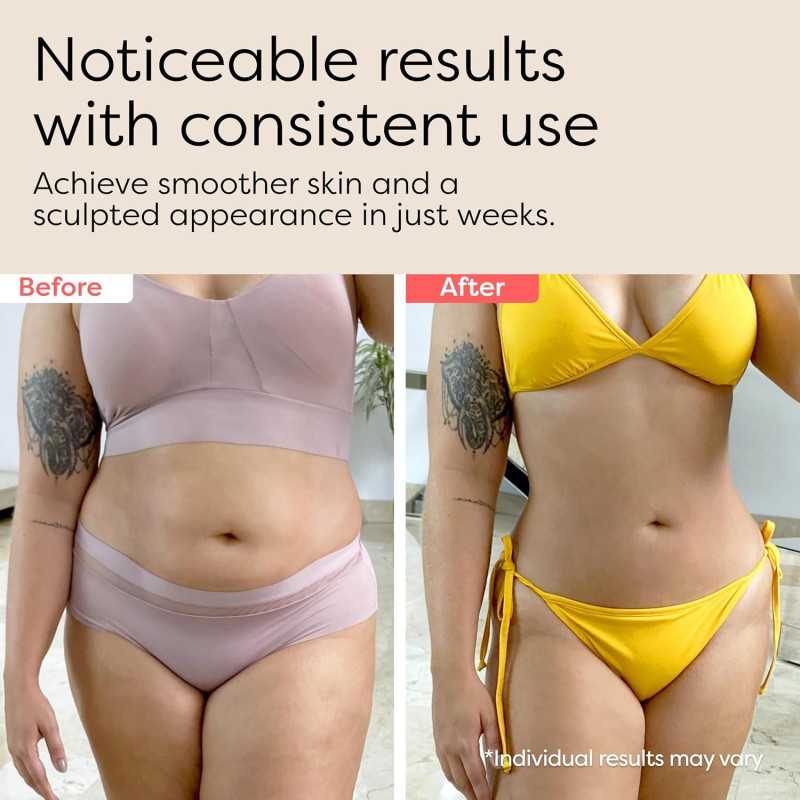 3-en-1 Sculptant Corps : Massager Anti-Cellulite et Raffermissant