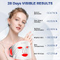 Masque LED Lovsheme: Thérapie Lumière Rouge, Bleue & Infrarouge - Anti-Âge, Acné & Rajeunissement Masque LED Lovsheme: Thérapie Lumière Rouge, Bleue & Infrarouge - Anti-Âge, Acné & Rajeunissement
