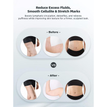 Massager Drainage Lymphatique : Anti-Cellulite & Vergetures