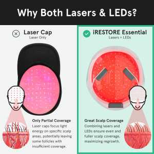 iRestore Essential Laser Hair Growth Cap: FDA Cleared. Regrow Thicker, Fuller Hair at Home!