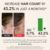 iRestore Essential Laser Cap — FDA-cleared solution for hair growth, thinning & alopecia in men & women!