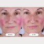 Masque LED CurrentBody Skin Series 2: Rajeunissement Avancé, Peau Visiblement Plus Jeune Masque LED CurrentBody Skin Series 2: Rajeunissement Avancé, Peau Visiblement Plus Jeune