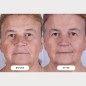Masque LED CurrentBody Skin Series 2: Rajeunissement Avancé, Peau Visiblement Plus Jeune Masque LED CurrentBody Skin Series 2: Rajeunissement Avancé, Peau Visiblement Plus Jeune
