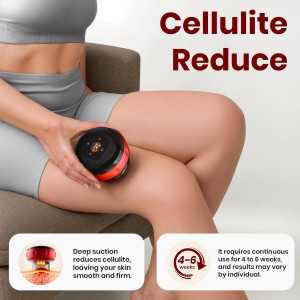 Becommend 5-in-1 Electric Cupping Therapy Set with 20-Level Heat & Suction, Red Light for Pain Relief (Red)