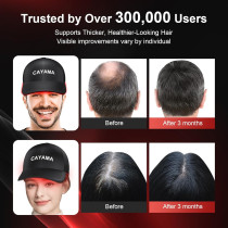 CAYAMA Red Light Therapy Hair Cap – 510 LEDs for Fuller Hair
