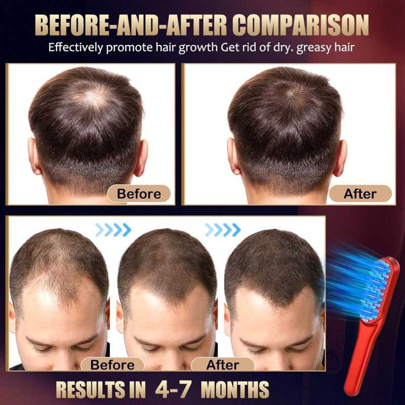 Peigne Laser Croissance Cheveux Rouge - Traitement Unisexe