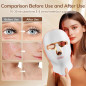 Cordless Red Light Therapy Face Mask, USB-C Rechargeable Infrared LED Mask for Home, Travel & Sleep Cordless Red Light Therapy Face Mask, USB-C Rechargeable Infrared LED Mask for Home, Travel & Sleep