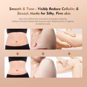 35-Speed 3-in-1 Lymphatic Drainage Massager with Microcurrent, Heat & Vibration – Anti-Cellulite Body Sculpting Tool (White)