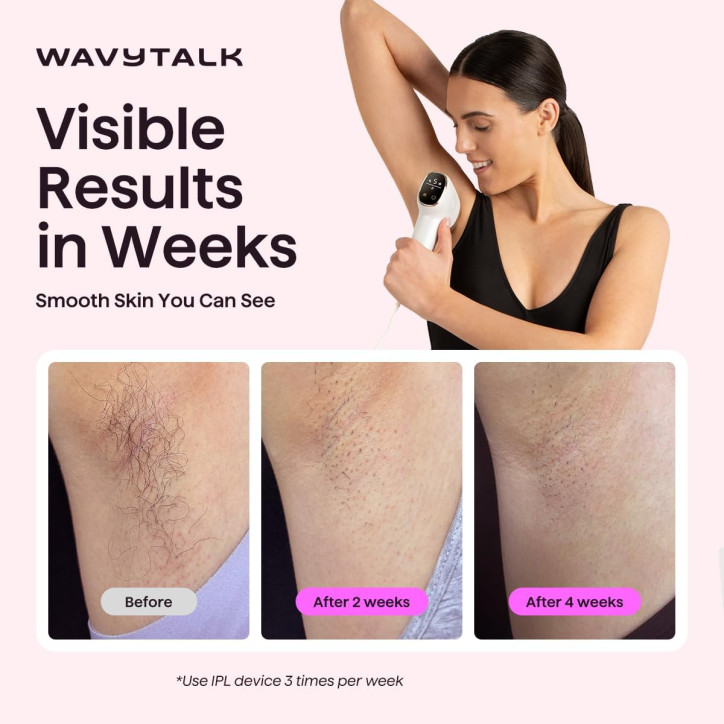 Appareil d'épilation IPL Wavytalk, corps complet en 12 min, indolore, double impulsion 24J, refroidissement glace Appareil d'épilation IPL Wavytalk, corps complet en 12 min, indolore, double impulsion 24J, refroidissement glace