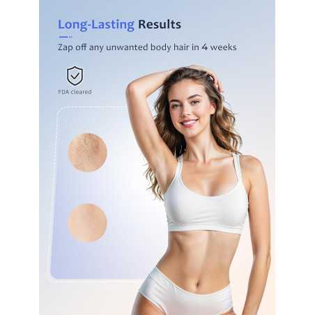 Ubroo IPL Laser Hair Removal Device with 5℃ Ice Cooling for At-Home Use – Gold