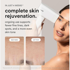 Nood™ NEW Flasher Pro : Épilation IPL & Anti-Âge Indolore