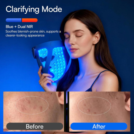 INIA Glow 4D Wireless Red Light Therapy Mask – 320 LEDs, Dual NIR, 4 Modes, Under-Eye Cooling, Rechargeable