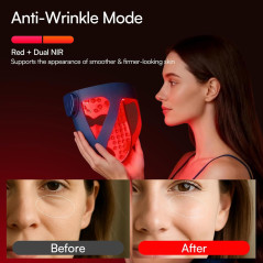 INIA Glow 4D Wireless Red Light Therapy Mask – 320 LEDs, Cordless & Rechargeable